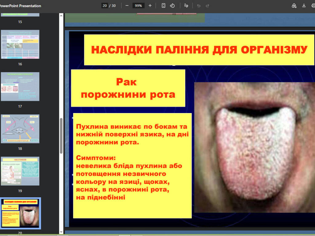 Шкідливий вплив тютюнопаління на здоров’я людини